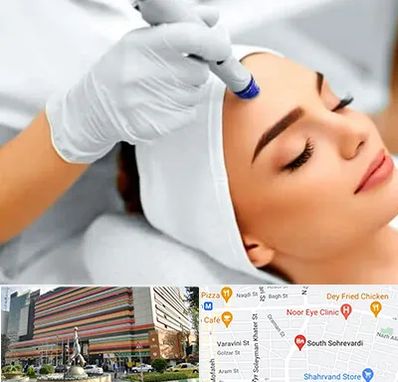 آموزش مزوتراپی در سهروردی 