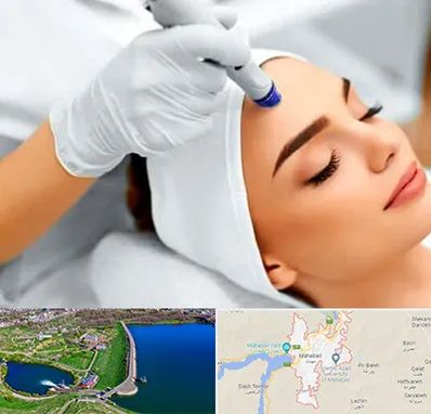 آموزش مزوتراپی در مهاباد
