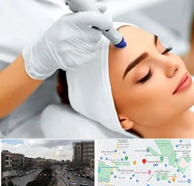 آموزش مزوتراپی در بلوار فردوسی مشهد 