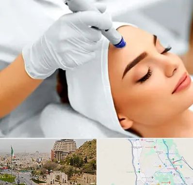 آموزش مزوتراپی در فرهنگ شهر شیراز 