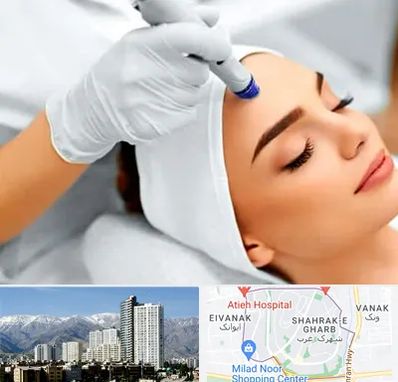 آموزش مزوتراپی در شهرک غرب 