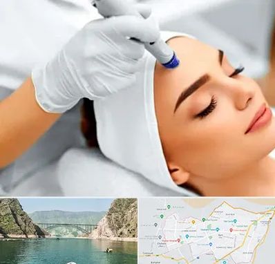 آموزش مزوتراپی در ایلام
