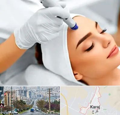 آموزش مزوتراپی در گوهردشت کرج 