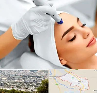 آموزش مزوتراپی در یاسوج