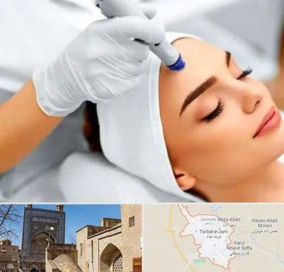 آموزش مزوتراپی در تربت جام
