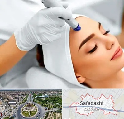 آموزش مزوتراپی در صفادشت