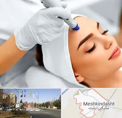 آموزش مزوتراپی در مشکین دشت