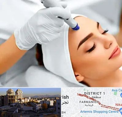 آموزش مزوتراپی در فرمانیه 