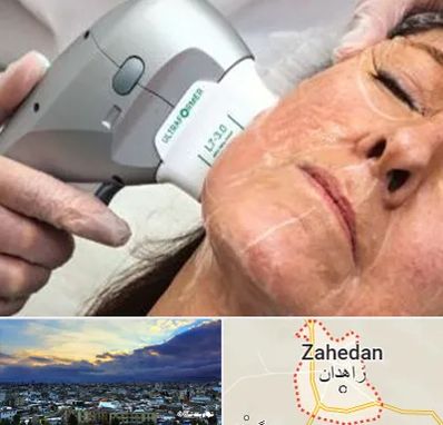 آموزش هایفوتراپی در زاهدان