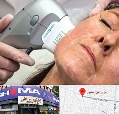 آموزش هایفوتراپی در امین حضور