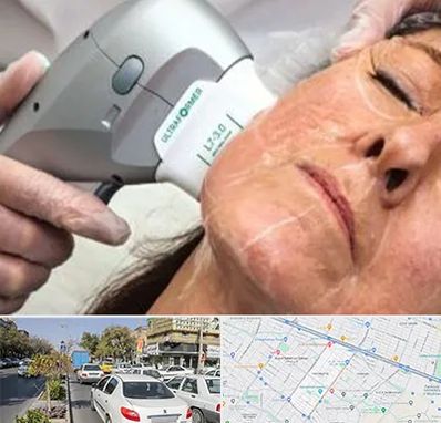 آموزش هایفوتراپی در مفتح مشهد 