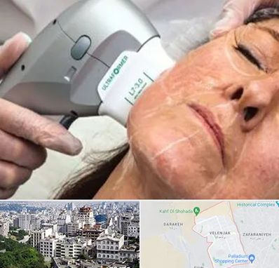 آموزش هایفوتراپی در ولنجک 