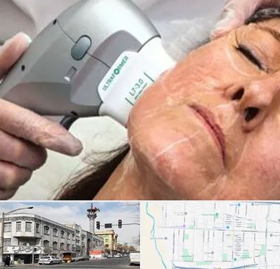 آموزش هایفوتراپی در 17شهریور