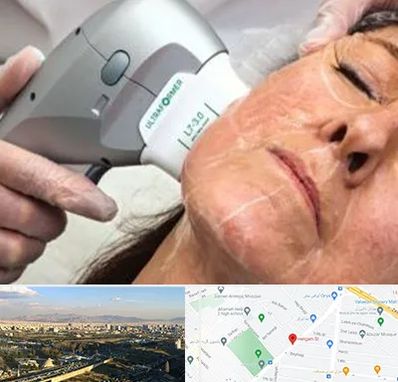 آموزش هایفوتراپی در هنگام 