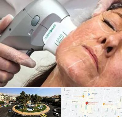 آموزش هایفوتراپی در هفت حوض 