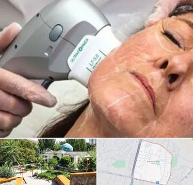 آموزش هایفوتراپی در باغمیشه تبریز