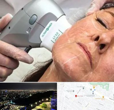 آموزش هایفوتراپی در هفت تیر مشهد 