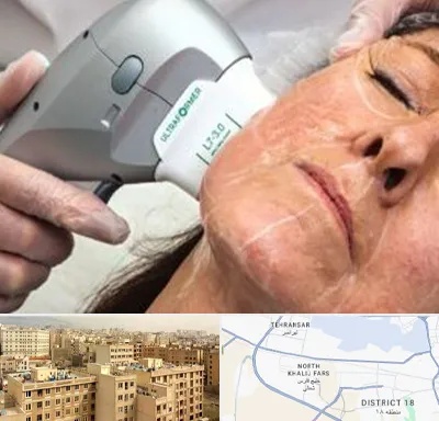 آموزش هایفوتراپی در جنوب غرب تهران