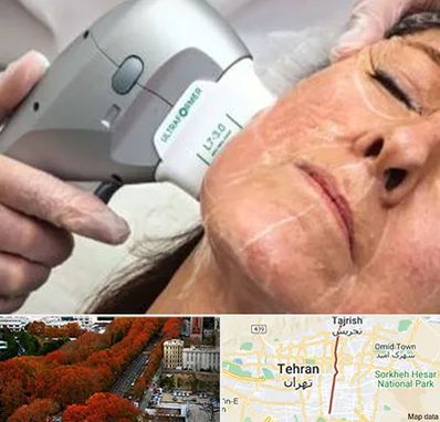 آموزش هایفوتراپی در ولیعصر 