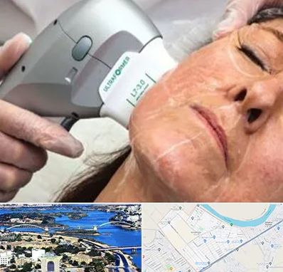 آموزش هایفوتراپی در کوروش اهواز 