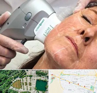 آموزش هایفوتراپی در وکیل آباد مشهد 