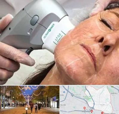 آموزش هایفوتراپی در ولیعصر ارومیه