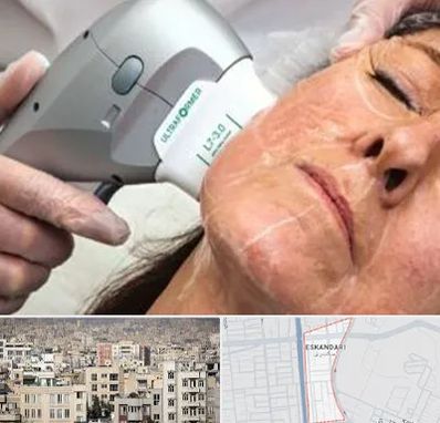 آموزش هایفوتراپی در اسکندری