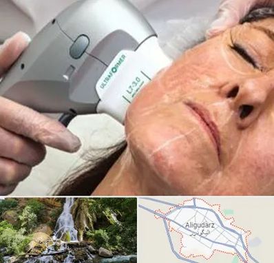 آموزش هایفوتراپی در الیگودرز