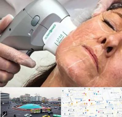 آموزش هایفوتراپی در میدان انقلاب 