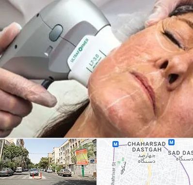 آموزش هایفوتراپی در چهارصد دستگاه 