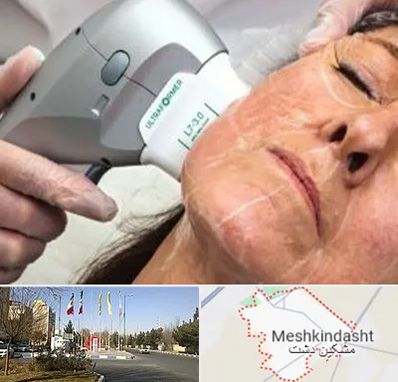 آموزش هایفوتراپی در مشکین دشت