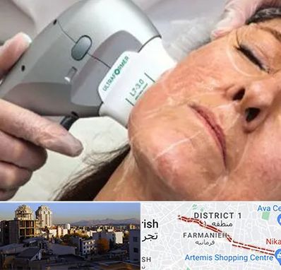 آموزش هایفوتراپی در فرمانیه 