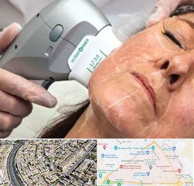 آموزش هایفوتراپی در شهرک غرب مشهد 