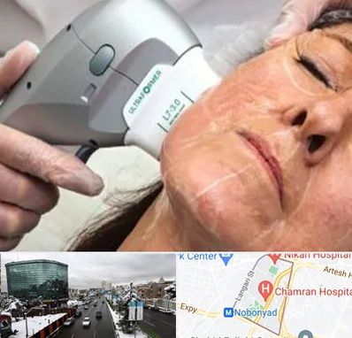 آموزش هایفوتراپی در اقدسیه 