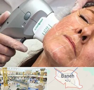 آموزش هایفوتراپی در بانه