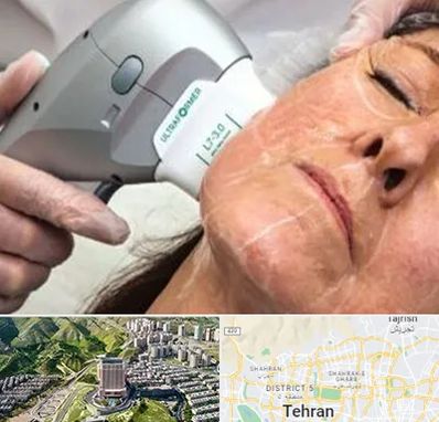 آموزش هایفوتراپی در شمال تهران 