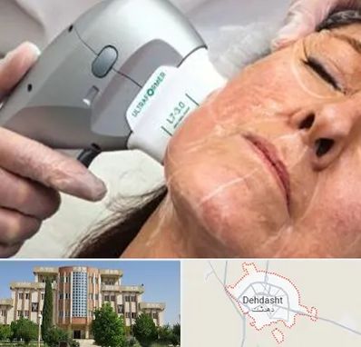آموزش هایفوتراپی در دهدشت