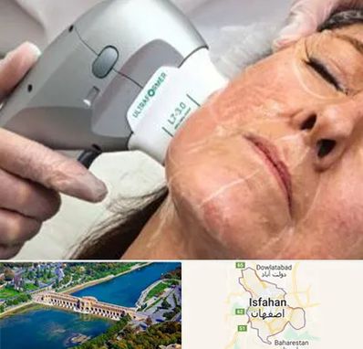 آموزش هایفوتراپی در اصفهان