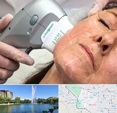 آموزش هایفوتراپی در کوهسنگی مشهد 