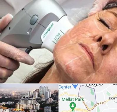 آموزش هایفوتراپی در الهیه 