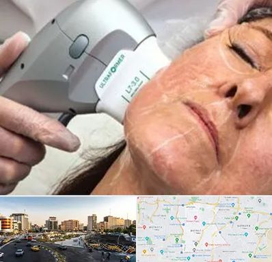 آموزش هایفوتراپی در منطقه 7 تهران 