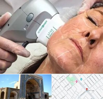 آموزش هایفوتراپی در مصلی مشهد