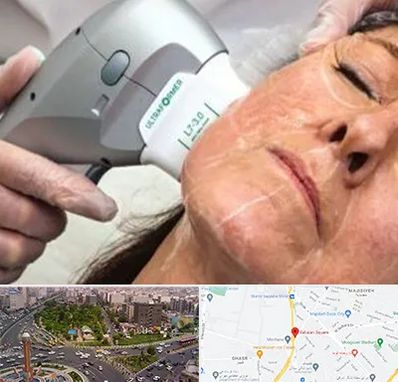 آموزش هایفوتراپی در سبلان 