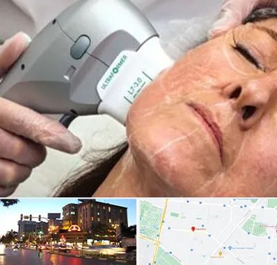 آموزش هایفوتراپی در بلوار سجاد مشهد 