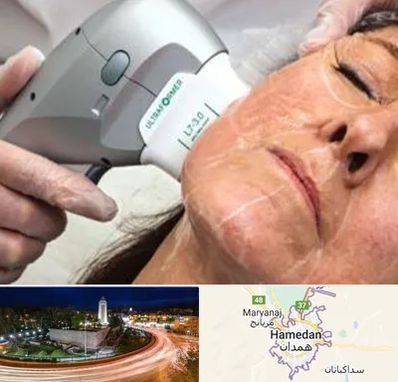 آموزش هایفوتراپی در همدان