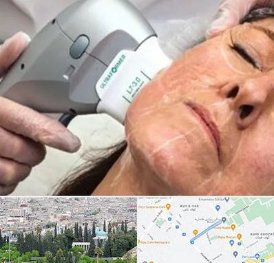 آموزش هایفوتراپی در محلاتی شیراز 