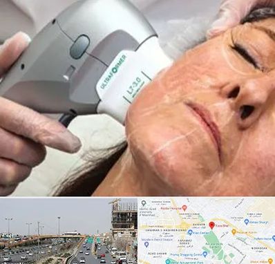 آموزش هایفوتراپی در بلوار توس مشهد 