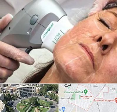 آموزش هایفوتراپی در جهانشهر کرج 