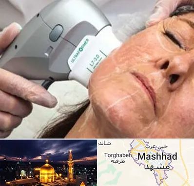 آموزش هایفوتراپی در مشهد