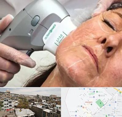 آموزش هایفوتراپی در شمیران نو 